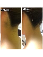 パーソナルエステティックサロン リボーン(ReBorn)/