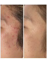 美顔研究所 バイ ヴィヴセカンド(美顔研究所 by viv 2nd)/