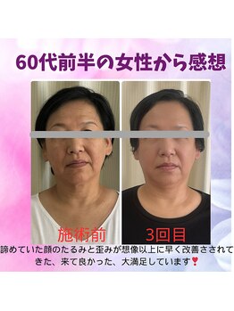 ハナノ整体院/姿勢矯正で背中が薄くなりました