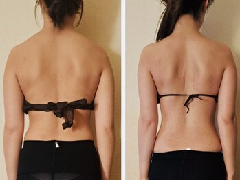 マナ(mana)/愛され花嫁ブライダル痩身2か月