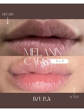 ビウラ(BIURA)/【ローマピンク】お客様の変化