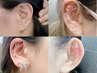 耳ツボ　お友達同時来店キャンペーン　二人で￥5000 両耳15粒までつけ放題