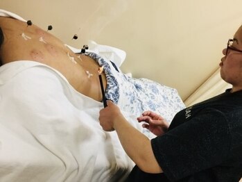 ルポ 那覇(repos)の写真/【お身体の不調ご相談ください】自律神経・ホルモンの乱れ/妊娠中の体調変化/めまい・頭痛・不眠などにも◎