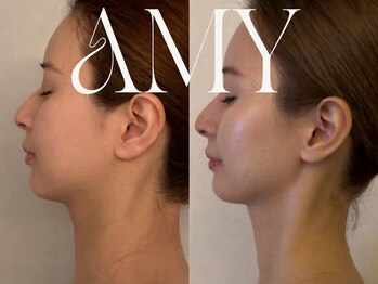 エイミー(Amy)/-【韓国式コルギ】-