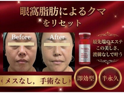 モテ美白の写真