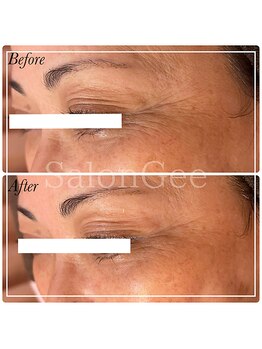 サロンジー(Salon Gee)/☆結果に自信あり☆