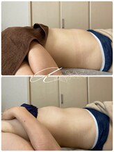 アランシア(Arancia)/