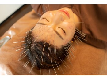 はりひろし鍼灸院/お顔のお悩みに☆