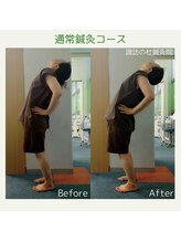 諏訪の杜鍼灸院/全身鍼灸