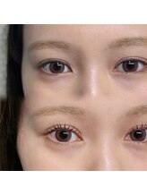 エクラートアイ アンド ローレル 大宮店(ECLART eye&Laurel)/