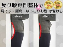 ストラボ 横浜店