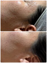 フィフ(fif)/＃ラミネーションピール