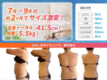ジール(ZEAL)/痩身/ダイエットプランのお客様