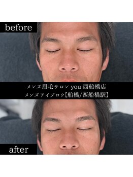 ユー 西船橋店(you)/ビフォーアフターお写真