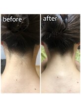 パーソナルエステティックサロン リボーン(ReBorn)/