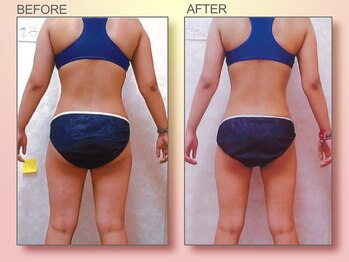 ジュリア オージェ 天王寺店/ビフォーアフター（ターゲット)