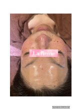 エステテックサロンラレーヌ 小山店(La Reine)/ヒト羊水幹細胞培養液を導入☆