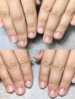 オリ('oli)の写真/フォルムにこだわり丁寧にお仕上げ♪深爪のお客様も美爪間違いなし！突発的な爪のトラブルにも対応◎