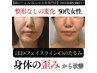 《インスタ広告見た方コレ》【美容整形なしのたるみ改善】リフトアップケア