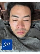 水素ジム911 心斎橋/剥けないハーブピーリング¥4,800