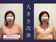 エレミュー 烏丸(Elemue.)/20代後半　《大きさ改善》