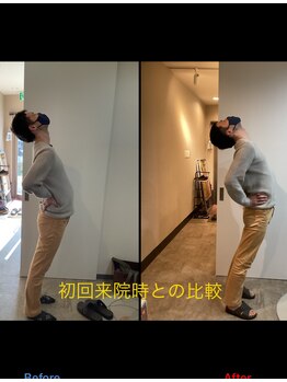 ストライクボディケア(STRIKE. BODY CARE)/腰痛施術