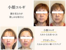 ビーサロン(B-salon)