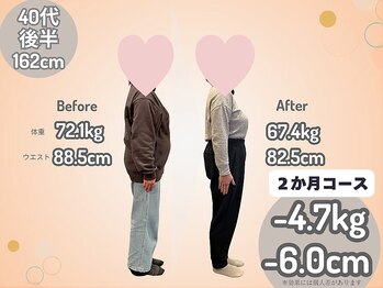 ひなた整骨院/ダイエット結果2ヶ月コース