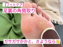 ル ソレイユ(Le soleil)の雰囲気(足裏やかかとのケアもお任せください♪)