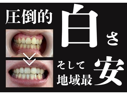 ミナ(mina)の写真