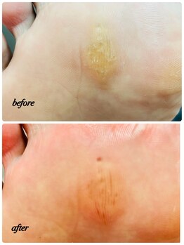 ラヴィ(La vie)/このために帰国