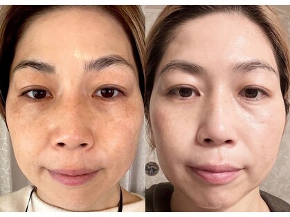 コモア(COMOA)の写真