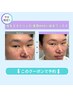 《新規/学割U24/人気No.2》美眉WAX+毛量調整(間引き/カット)×鼻毛WAX #眉毛