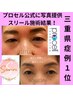 【三重県施術数No1】エステ要資格者オーナーが全て対応/業界最安値！