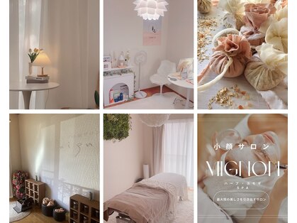 ミニョン(mignon)の写真