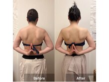 リバース 大阪店(Rebirth)/結果重視！肩甲骨出し姿勢改善