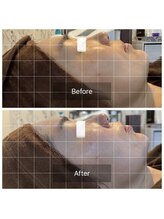 ラビ(RABBI)/女性30代レモンボトル小顔EMS