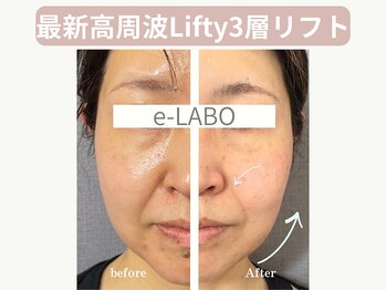 イーラボ 池袋店(e-LABO)の写真/エステで叶う、憧れの小顔！たるみ・もたつき改善で、キュッと引き締まった印象に◎