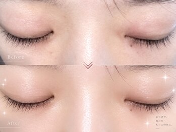 アイラッシュバーリー バイ ノブグループ(EYE LASH BARLEY by NOB GROUP)/伸びる自まつげ【まつげパーマ】