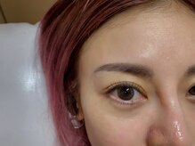 ヨヘン 芦屋店(YoHen)/フラット100本