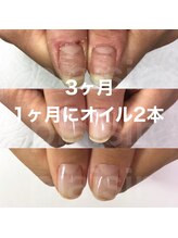 マリーシーオー(MARY-CO.)/自爪育成