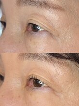 ダーム ド ローズ(Dame de rose)/【まぶたが上がるまつ毛パーマ】