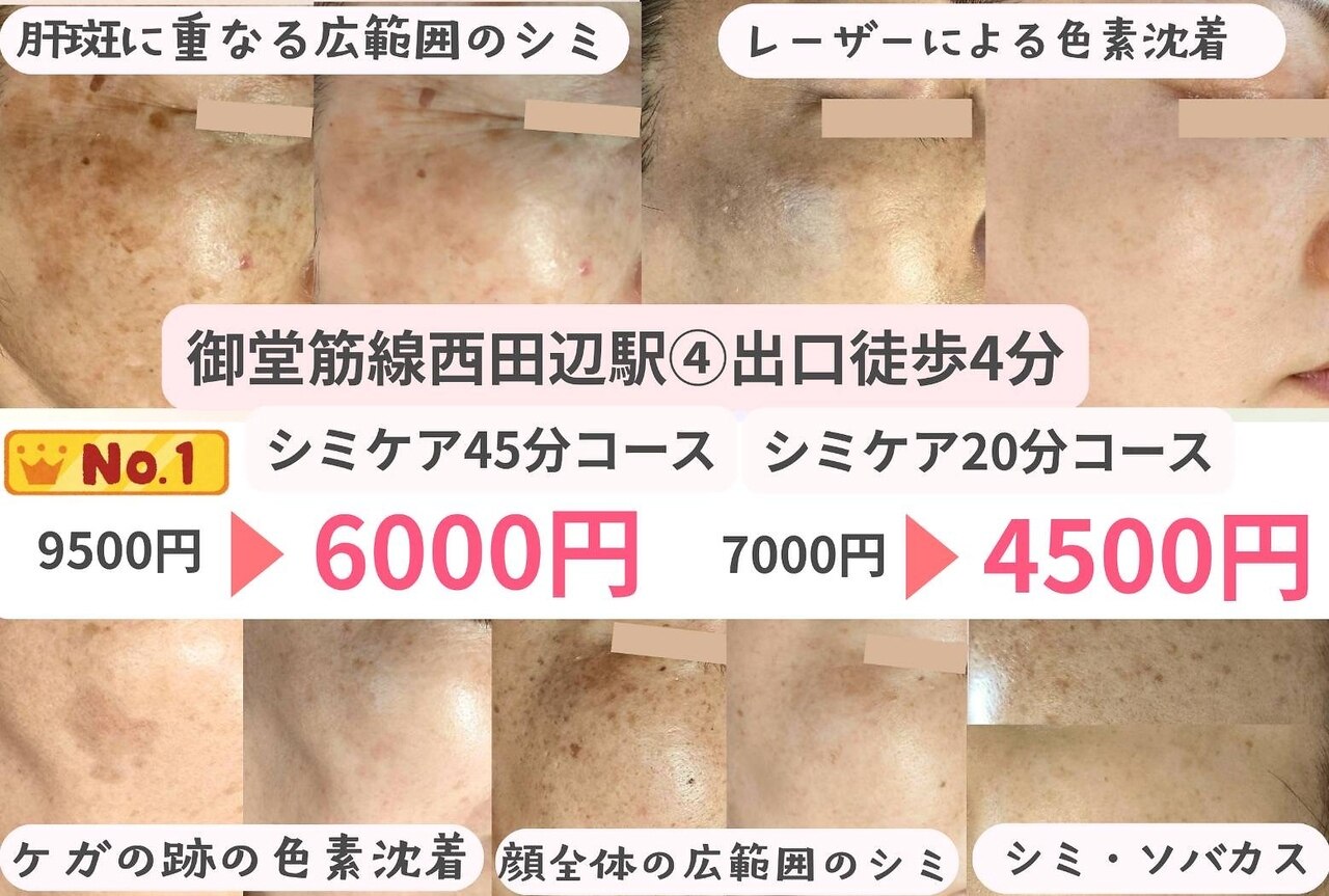 モモイロ(momoiro)｜ホットペッパービューティー