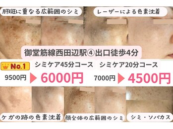 モモイロ(momoiro)