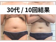 リストアミー(Restore me)/産後太りもお任せください♪