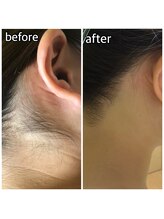 パーソナルエステティックサロン リボーン(ReBorn)/