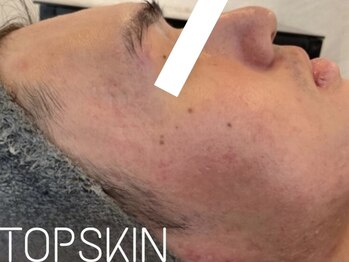 トップスキン 名駅(TOPSKIN)/揺らぎのない肌づくり