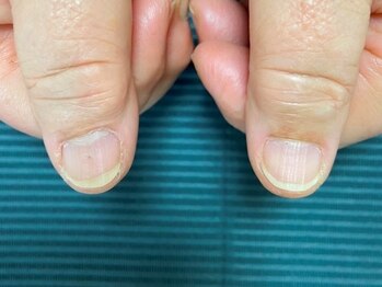 ダイヤモンドボディの写真/人前に出しても恥ずかしくない爪へ◎本来の爪の美しさを最大限に引き出すケアで自分の爪を好きになろう♪
