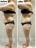 【Body人気No.1★】浮腫み、歪み、セル撃退！スッキリボディ筋膜ケア120分