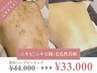 【夏前ケア！】肌見せ☆背中ハーブピーリング★ニキビケア/くすみゼロ★